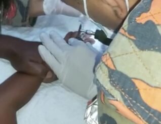 Main skru, jari kanak-kanak di Kudat tersekat