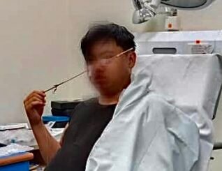 Anak panah tertusuk hidung, remaja berdepan cemas di Ranau  